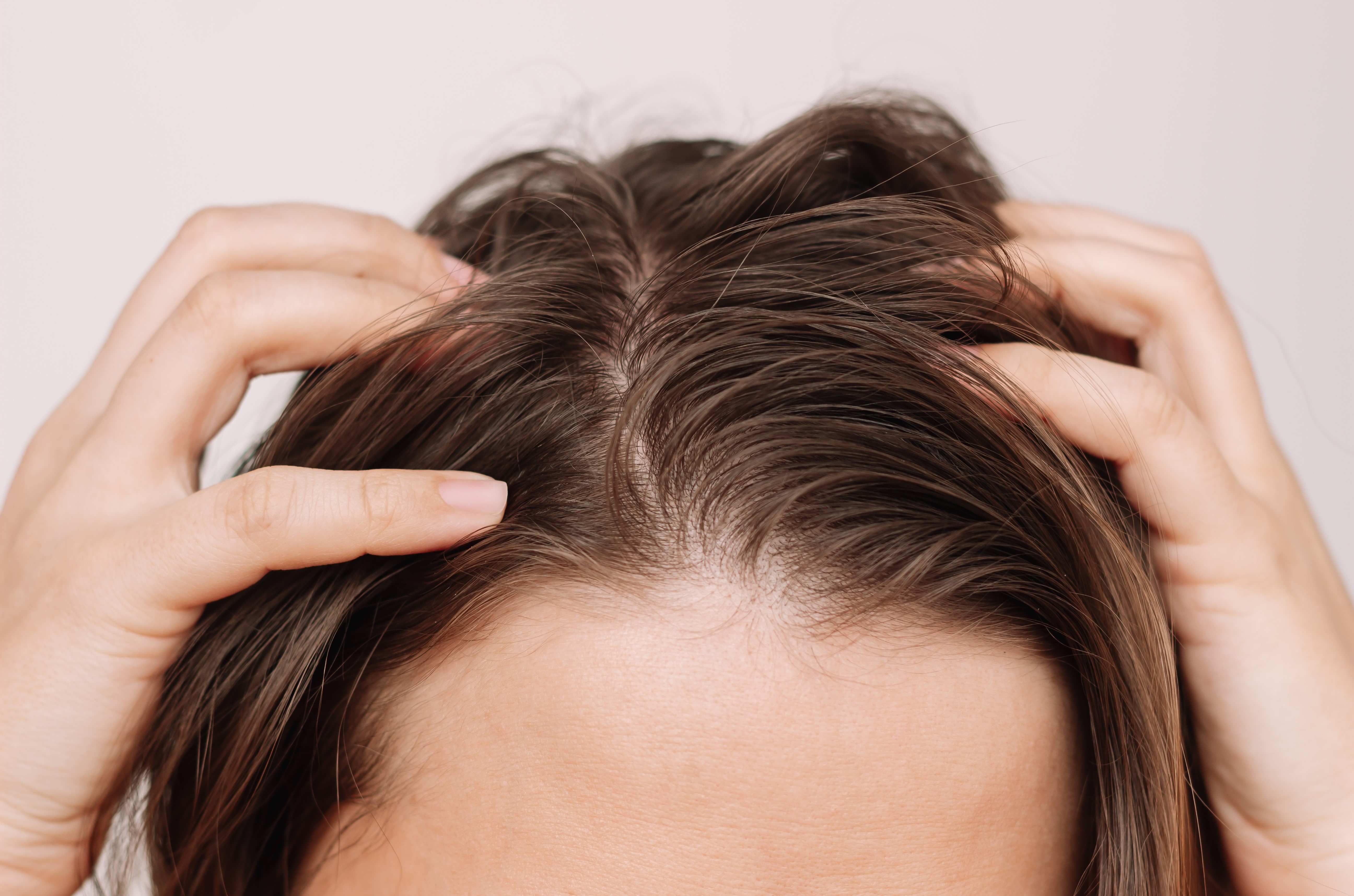 hair-oil-control-solution-recommendation