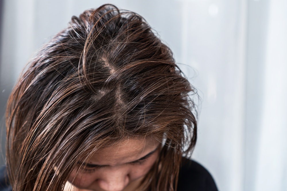 dry-hair-oil-hair-treatment-recommendation